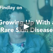 Carly Findlay rare skin disease